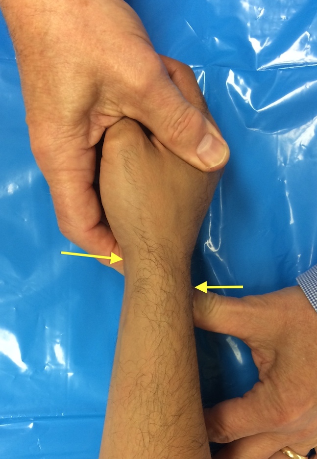 Ballottement Test for LT Ligament Laxity